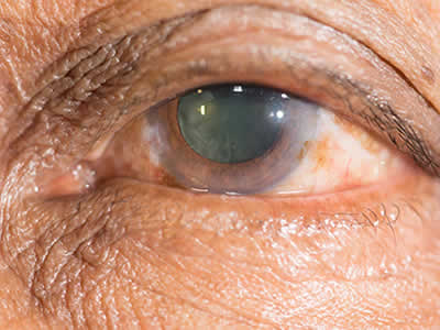 OFTALMOLOGOS QUITO NORTE