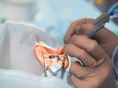 OFTALMOLOGOS QUITO NORTE