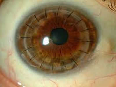 OFTALMOLOGOS QUITO NORTE