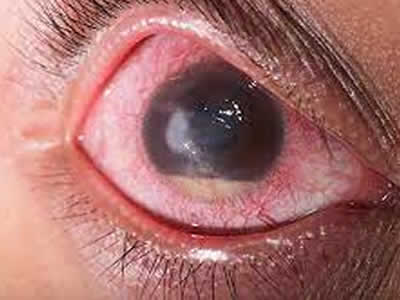 OFTALMOLOGOS QUITO NORTE