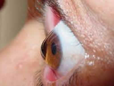 OFTALMOLOGOS QUITO NORTE