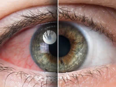 OFTALMOLOGOS QUITO NORTE